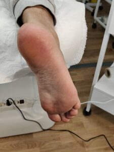 After 3 - Pedicure