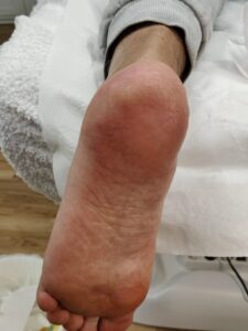 After 4 - Pedicure