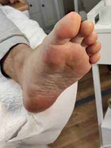 After 5 - Pedicure