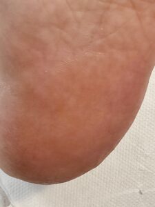 After 7 - Pedicure