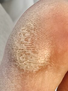 Before 4- Pedicure