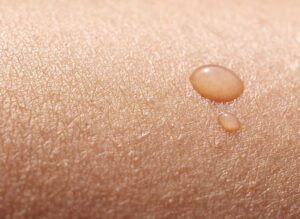 What is the Skin Microbiome?