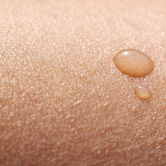 face of woman with dry skin