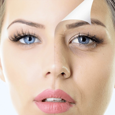 Mesotherapy treatment